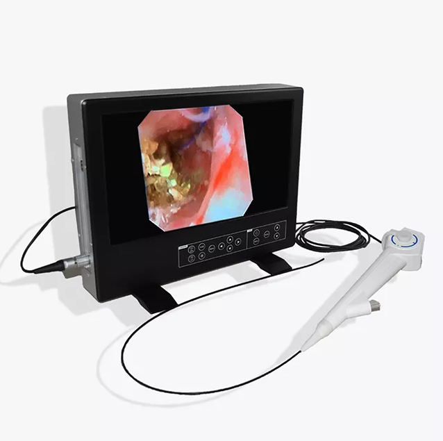 Flexible Choledochoscope