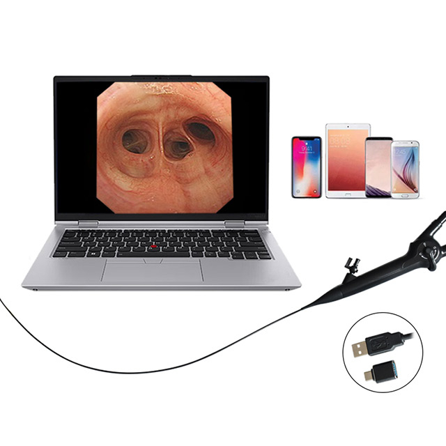 Reusable HD Flexible Bronchoscope