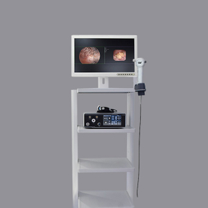 HD-820 Dual-lens Joint Integrated Rigid and Flexible Endoscopy System
