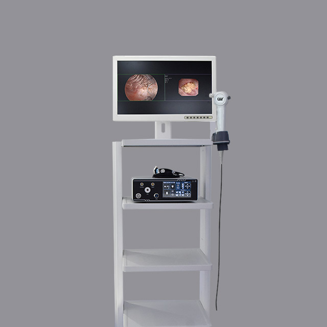 HD-820 Dual-lens Joint Integrated Rigid and Flexible Endoscopy System