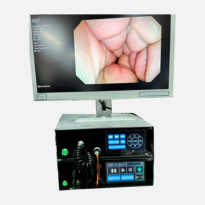 HD Imaging Gastroscopes & Colonoscopes – Enhanced Clarity & Precision