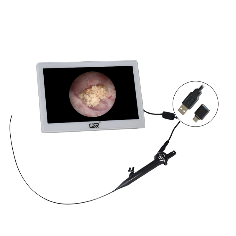 HD Electric Urology Reusable Metal Ureteroscope Flexible