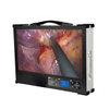 Portable 4K Medical Endoscope Camera 
