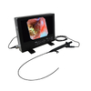 Single Use Minimally Invasive Surgery Flexible Choledochoscope