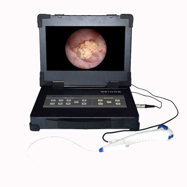 133 Integrated Endoscope Camera System+flexible Endoscope