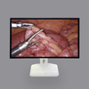 27-Inch 4k LCD Medical Monitor