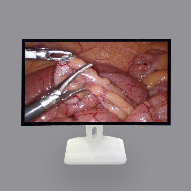 27-Inch 4k LCD Medical Monitor