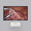 27-Inch 4k LCD Medical Monitor