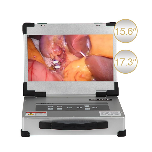 HD-320 Portable 1080P Integrated Endoscope Camera – Dual-Use for ENT & Gynecology Procedures