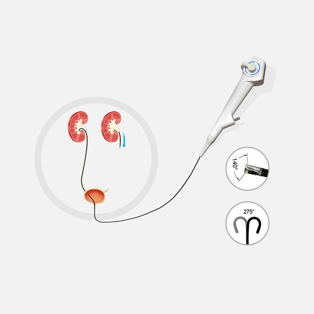 Digital Ureteroscope