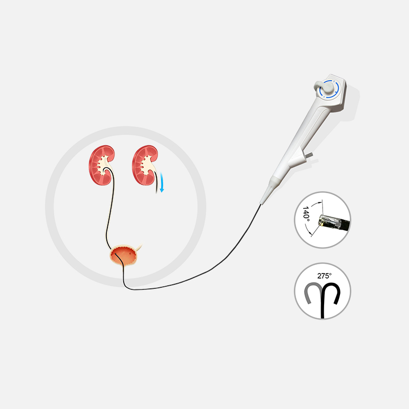 HD Electric Urology Video Ureteroscope Flexible