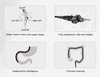 Portable Veterinary Endoscopy System Integrated All-in-One Endoscope for Gastroscope Colonoscope