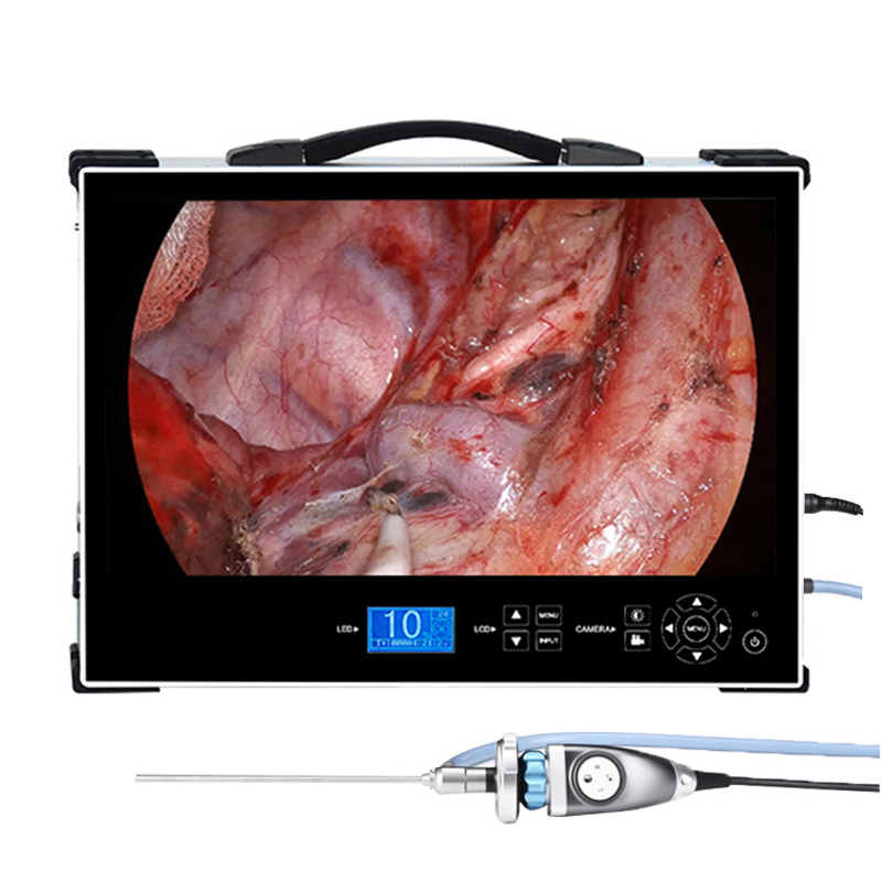 Portable 32 Inch Integrated Endoscope Camera