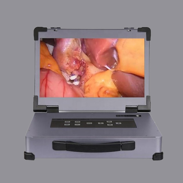 Portable HD1080P Integrated Endoscope Camera HD-320