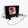 Single Use Minimally Invasive Surgery Flexible Choledochoscope