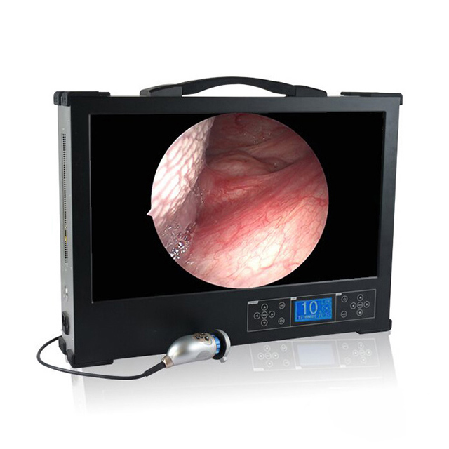 Portable HD 1080P 27-inch medical endoscope
