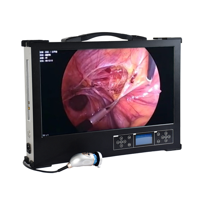 Portable HD 1080P 27-inch medical endoscope