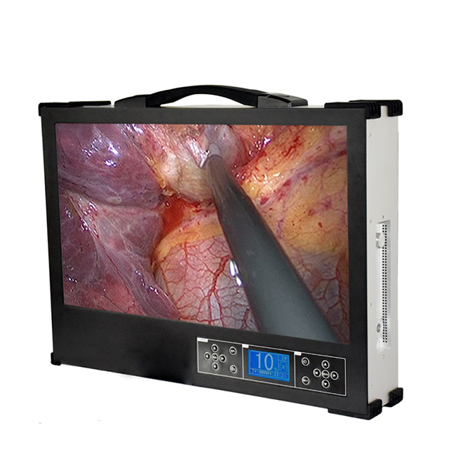 Portable 21 Inch Integrated Endoscope Camera