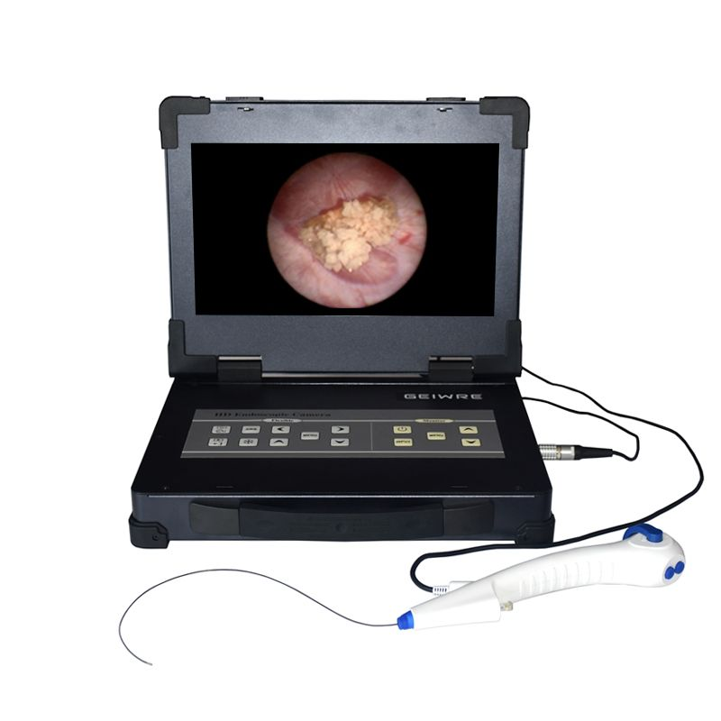 133 Integrated Endoscope Camera System+flexible Endoscope