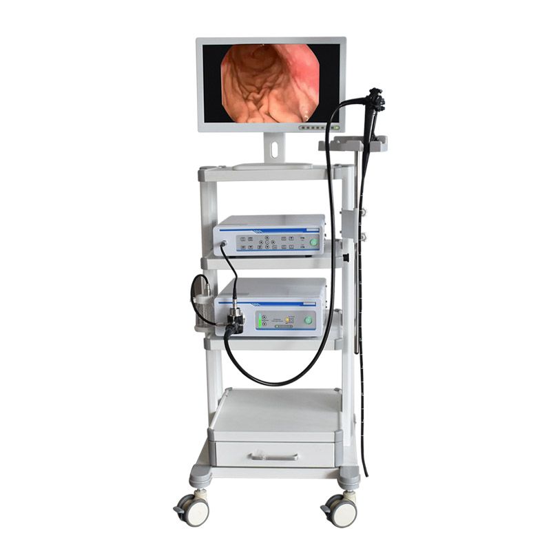 Electronic Gastroscopy