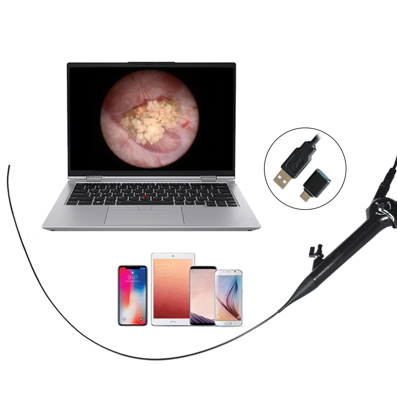 Reusable Minimally Invasive Surgery Flexible Choledochoscope