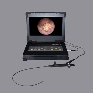 2.5-5.1mm flexible endoscope Reusable Choledochoscope for Minimally Surgery 