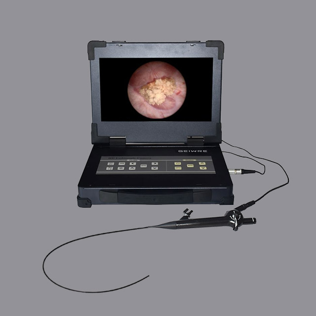 2.5-5.1mm flexible endoscope Reusable Choledochoscope for Minimally Surgery 