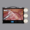 HD-390 All-in-One 4K Endoscopic Camera System