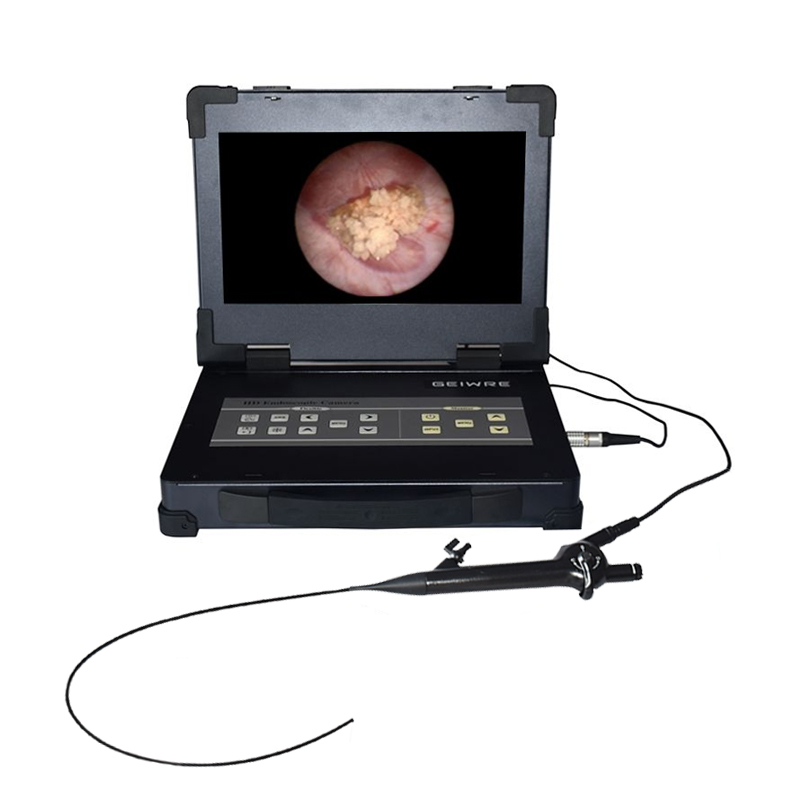 Flexible Choledochoscope