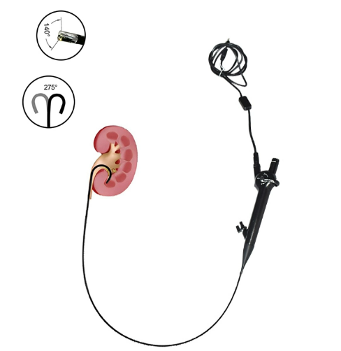 Flexible Ureteroscope8.png