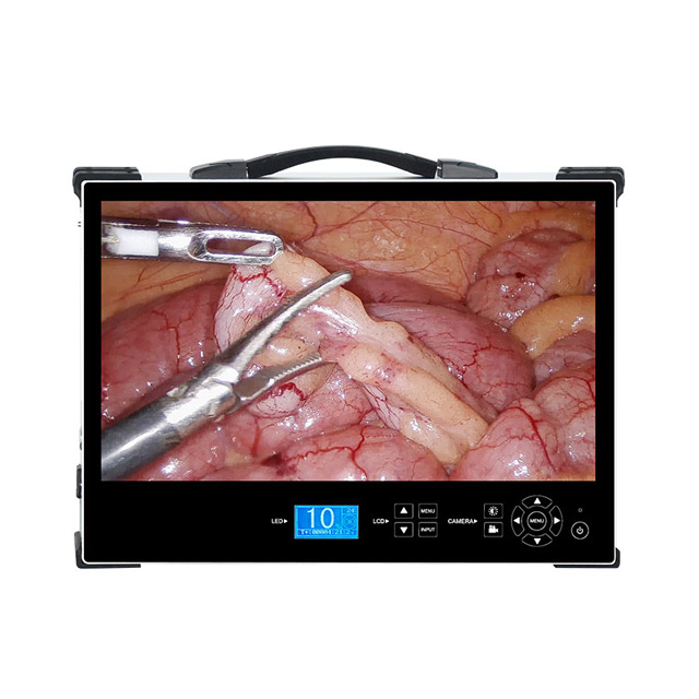 HD-380 21" All-in-One Endoscopic Camera System | 1920&times;1200 HDMI/SDI Output for ENT Laparoscope