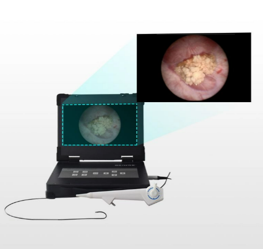 Flexible Ureteroscope5.png