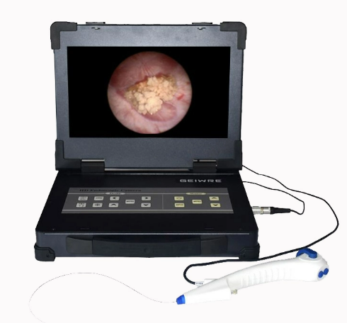 Flexible Ureteroscope3.png