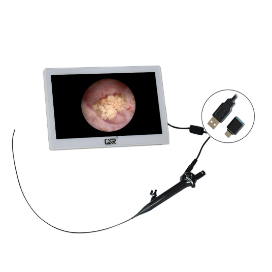 Flexible Ureteroscope11.png